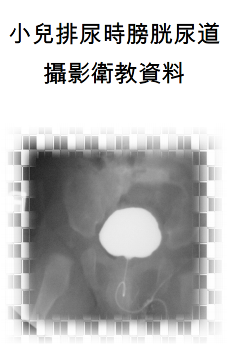 小兒排尿時膀胱尿道攝影衛教資料照片.jpg