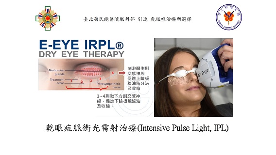 Novel Device for Dry Eye Treatment ��